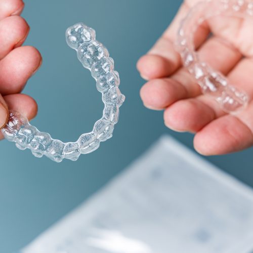 Invisalign - Smile Design Charleston